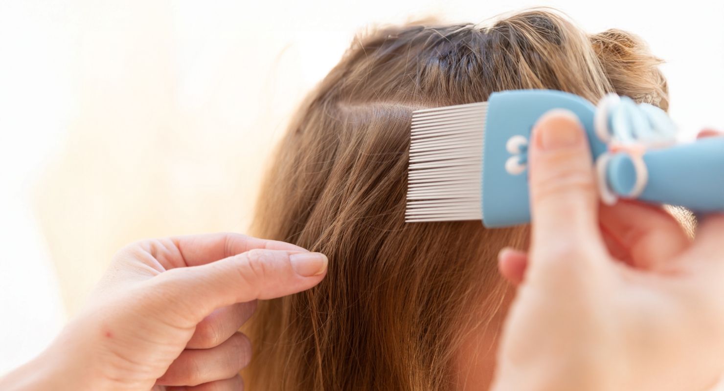 Pidocchi nei bambini