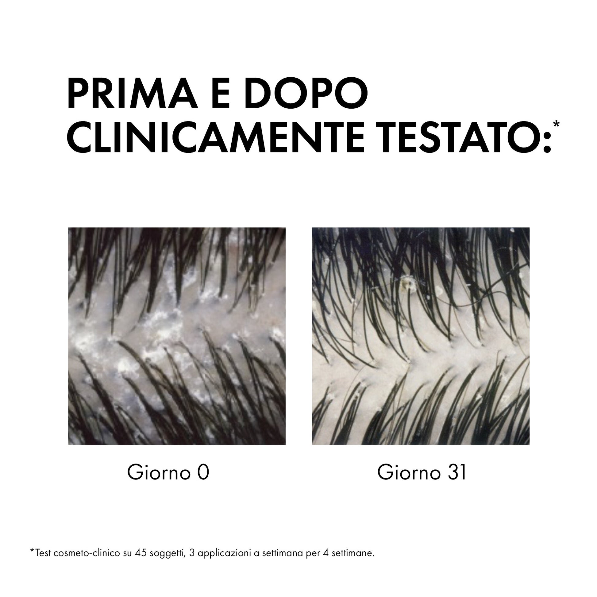 Vichy Dercos Shampoo Antiforfora capelli da normali a grassi 390 ml-4