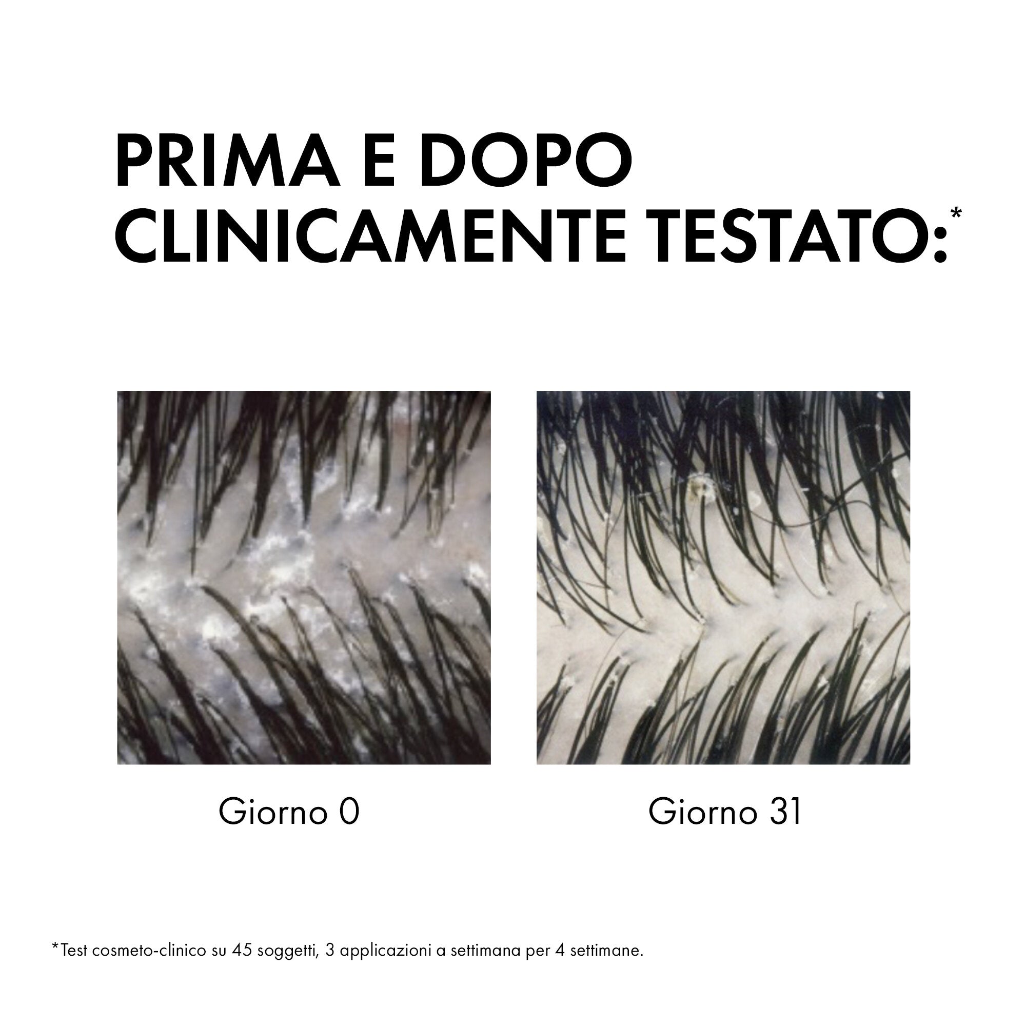 Vichy Dercos Shampoo Antiforfora capelli da normali a grassi 390 ml-4