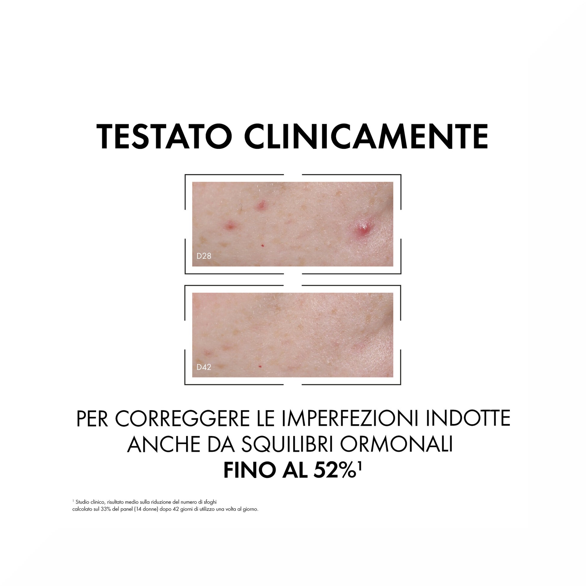 Vichy Normaderm Probio-Bha Siero Anti-Imperfezioni 30 ml-5
