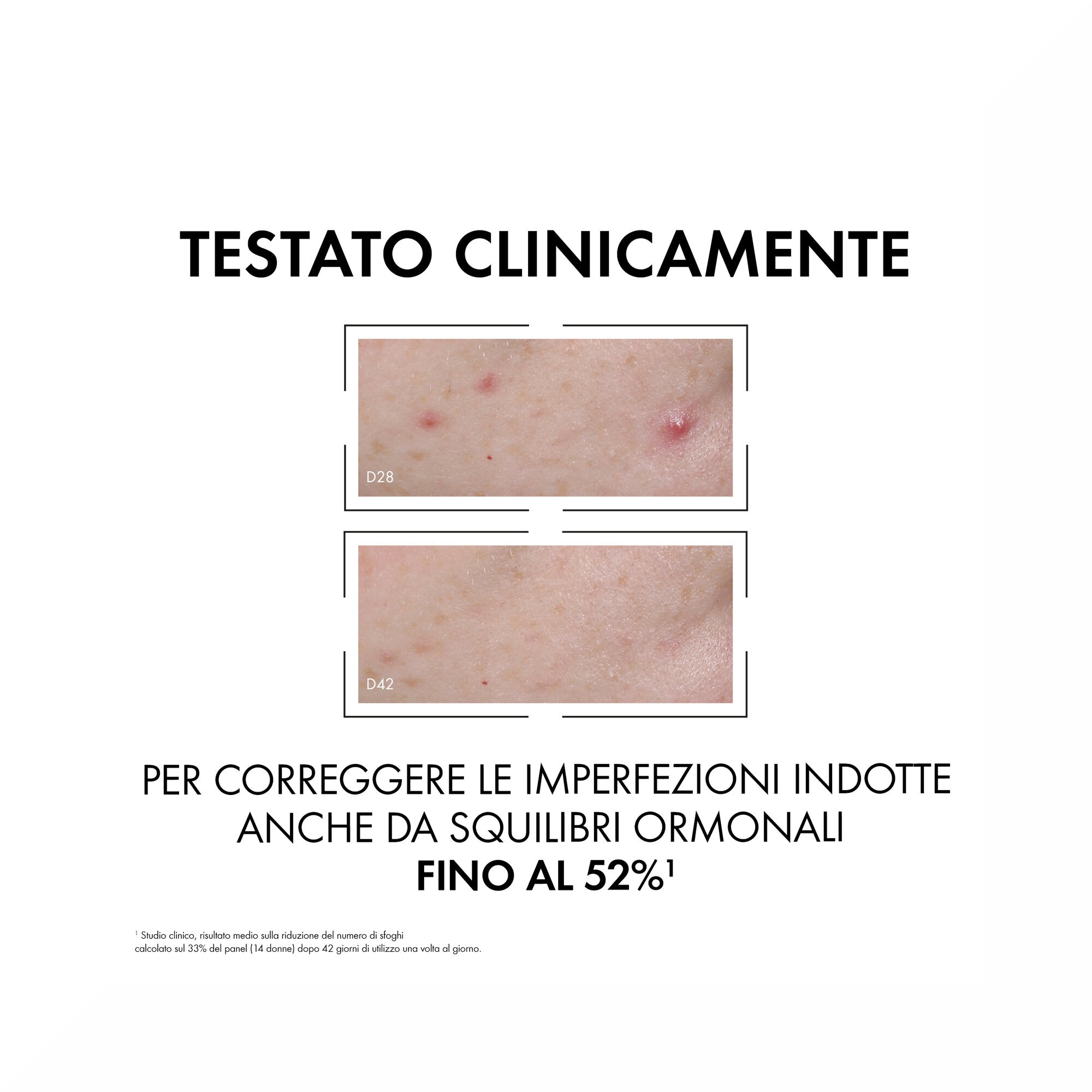 Vichy Normaderm Probio-Bha Siero Anti-Imperfezioni 30 ml-5