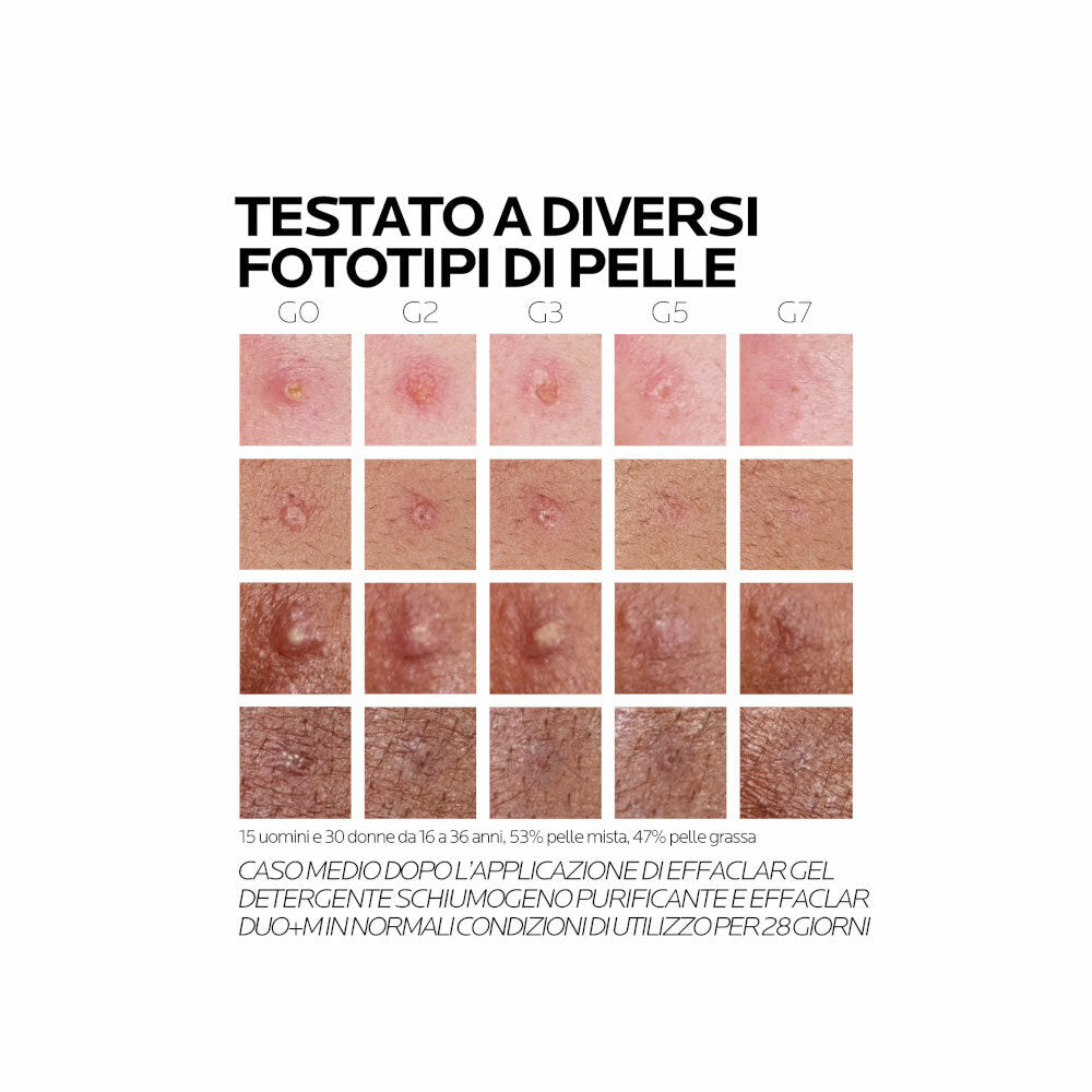 La Roche Posay Effaclar Duo+M Trattamento Viso Anti-Imperfezioni 40ml-3
