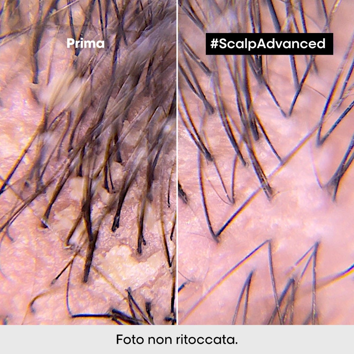 LP SE Scalp A-Dndrf Shp 500 R VB98