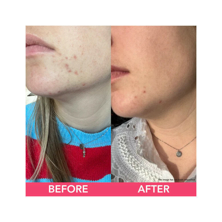 Teaology Matcha Fresh Cream Crema Viso Freschezza Assoluta Idratante Anti-inquinamento 50ml-5