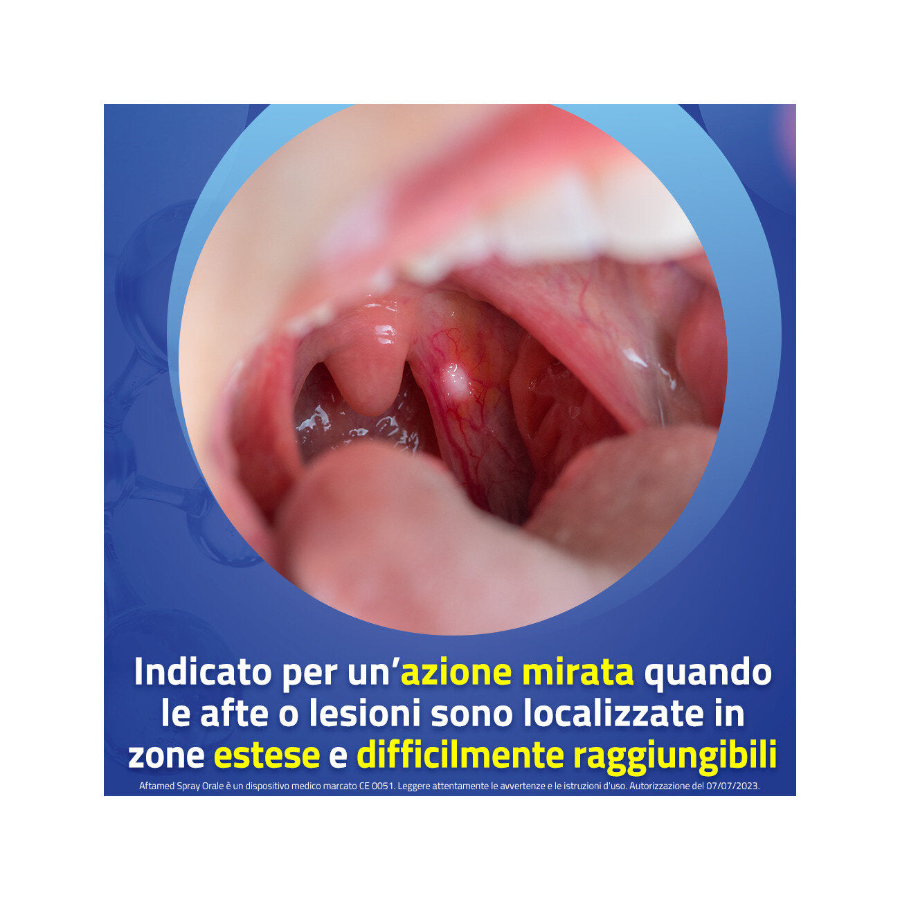 Aftamed Riduce Immediatamente il dolore spray 20ml-11