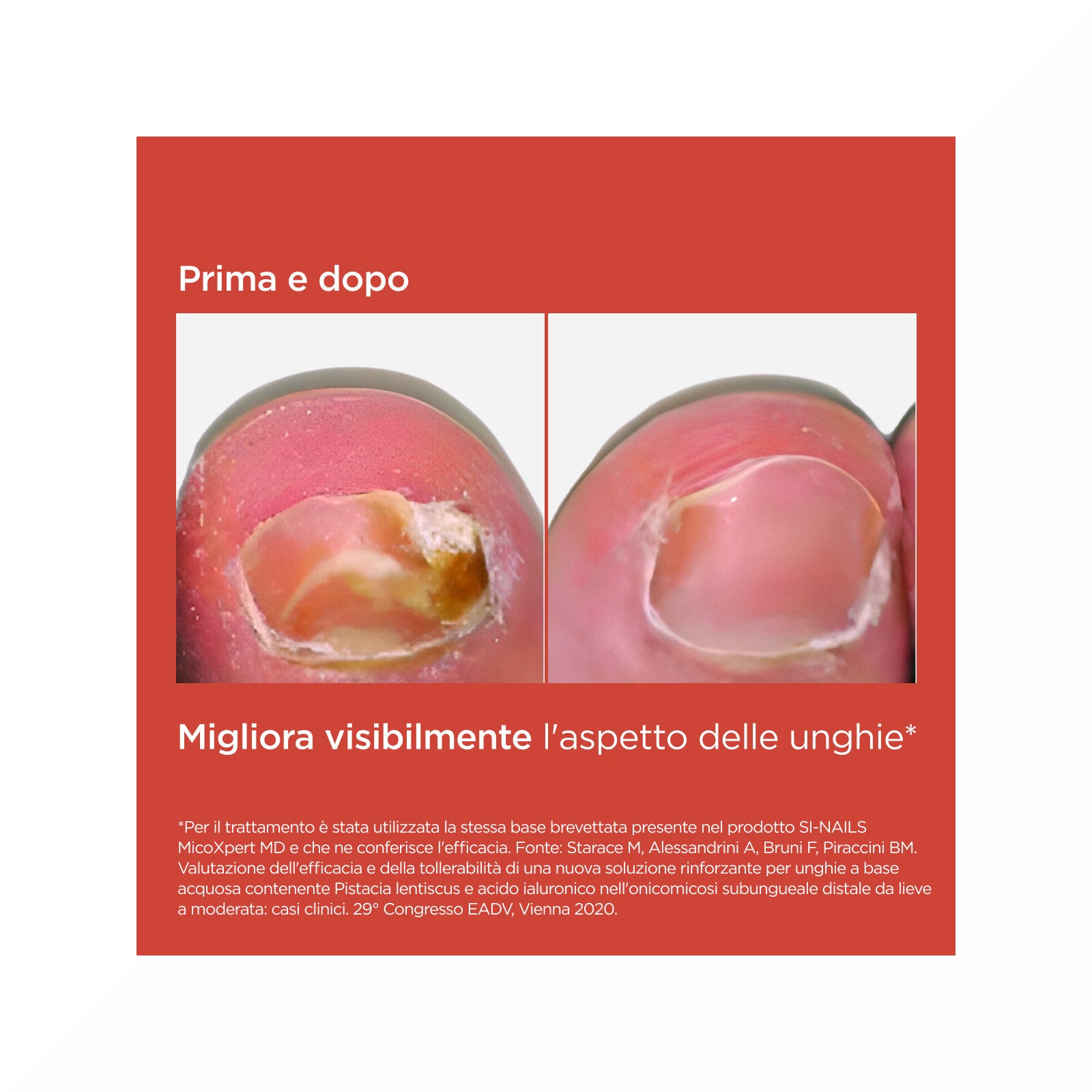 Isdin Si-Nails Micoxpert Md Trattamento Unghie Infezioni Fungine 4,5ml-5