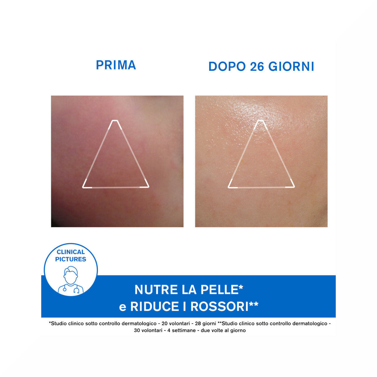 Uriage Xémose Crema viso 40ml-5