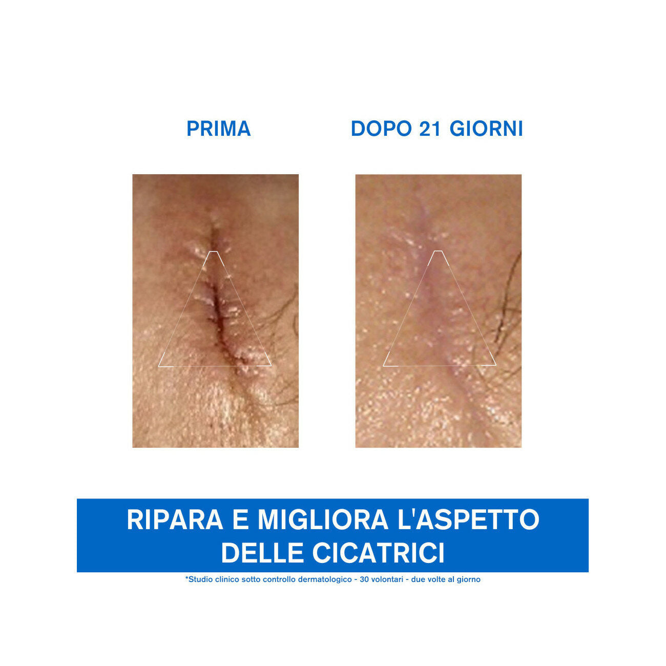 Uriage Bariéderm Cica-Crema riparatrice 100ml-4