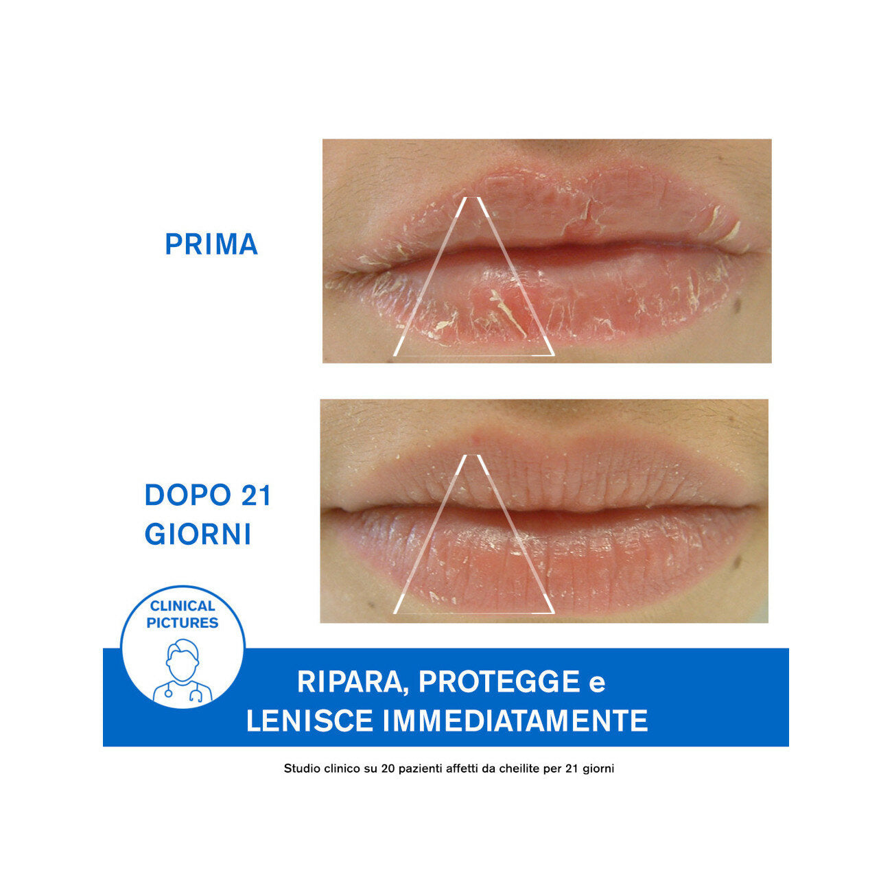 Uriage Bariéderm Cica-Lèvres Balsamo isolante labbra 15ml-5