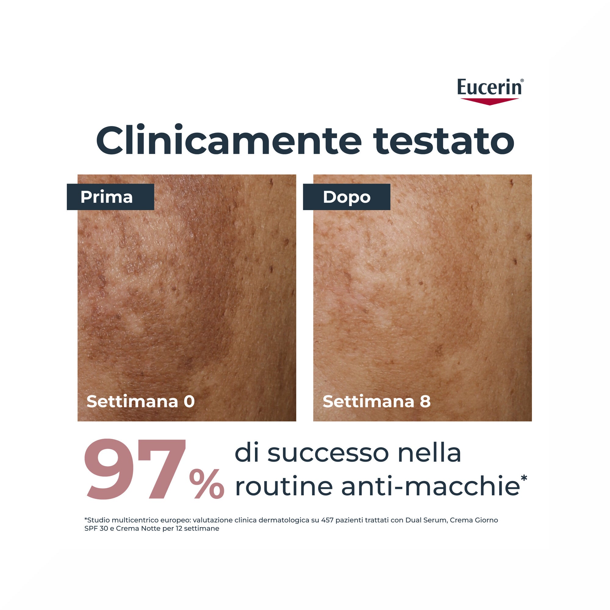 Eucerin AntiPigment Giorno SPF30 50ml-3
