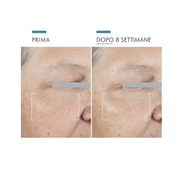 AGE ADVANCED EYE 15ML-5