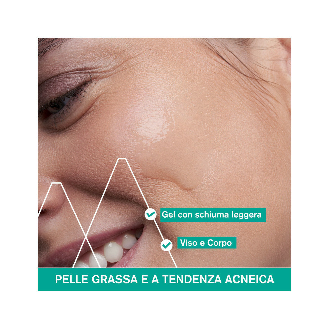 Uriage Hyséac Gel Detergente 150ml-2