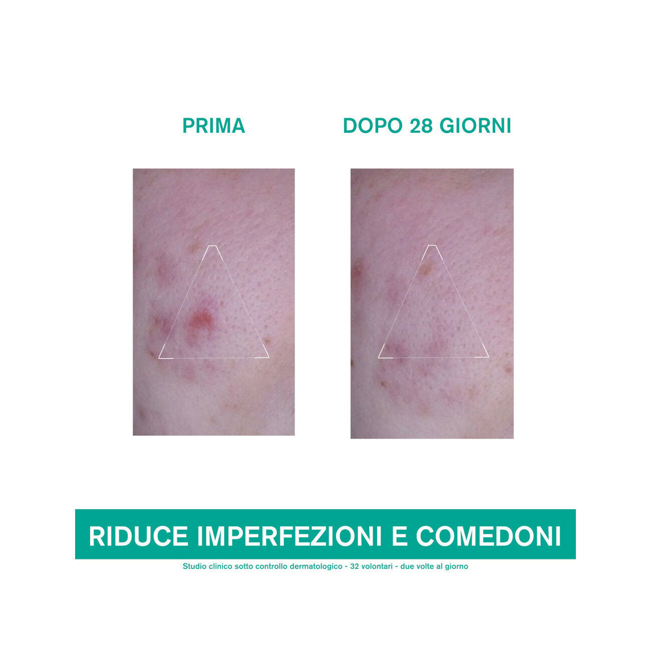 Uriage Hyseac 3 Regul+ Trattamento Globale Anti-imperfezioni 40ml-3