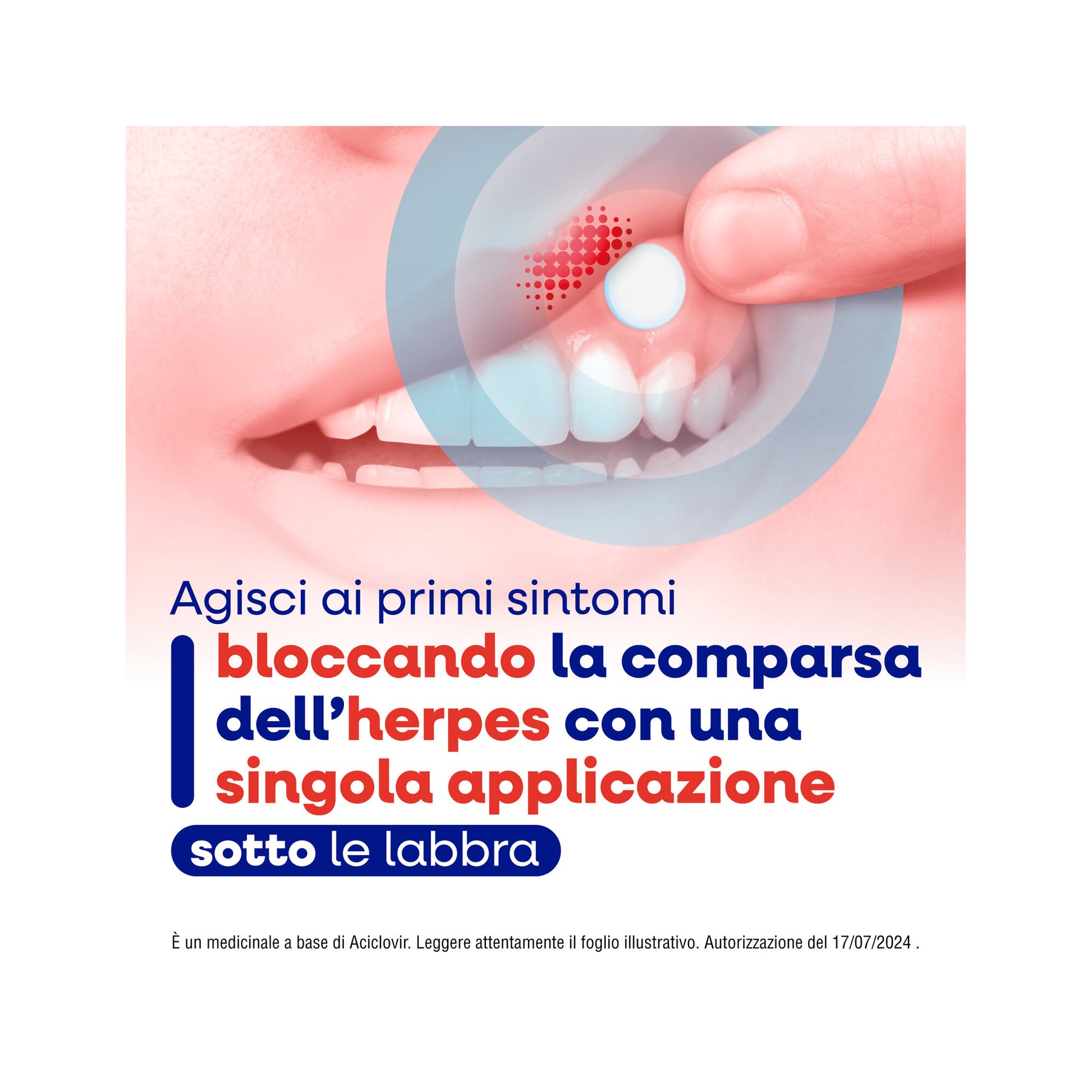 Herpmed Labiale 50mg 2 Compresse Buccali Mucoadesive-4