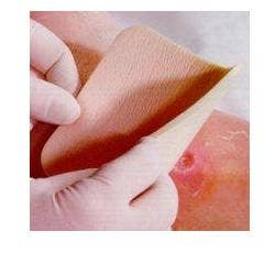 ALLEVYN NON ADHESIVE 20X20CM 3-1