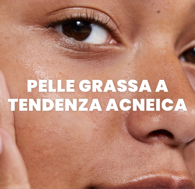 Pelle grassa a tendenza acneica