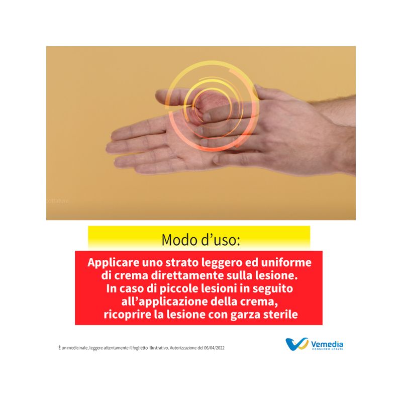 Foille Crema per ustioni, bruciature e scottature domestiche 29,5 g-4