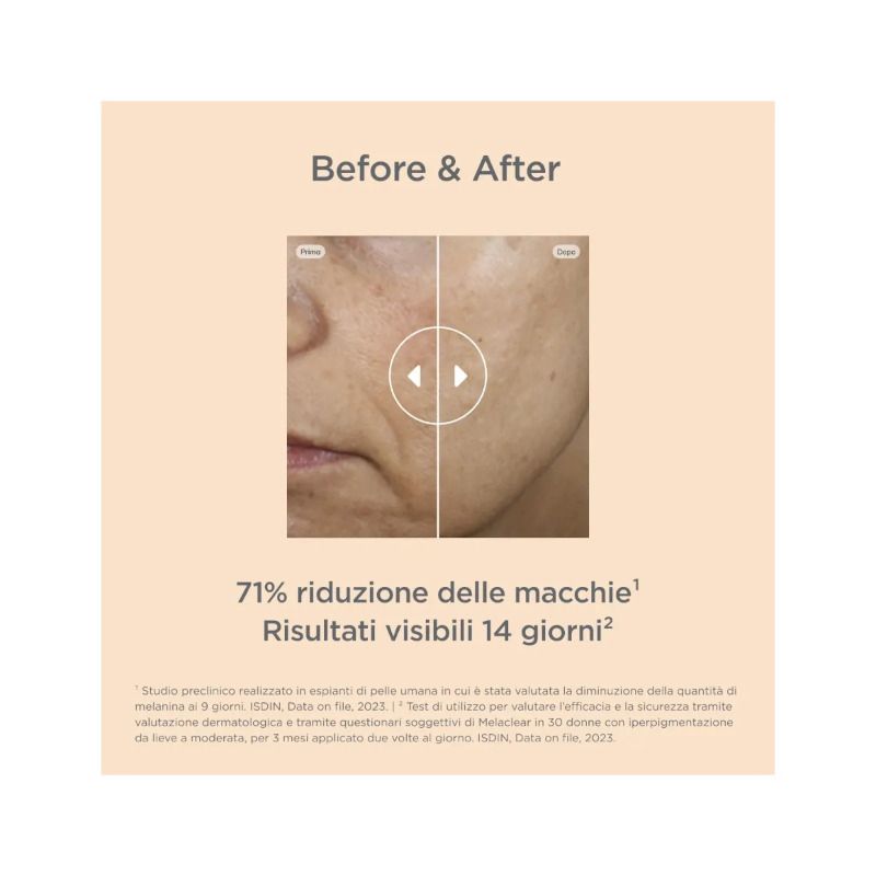 Isdinceutics Melaclear Siero Antimacchie 30ml-6
