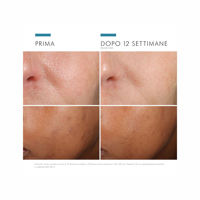 SkinCeuticals Phloretin CF Siero viso antiossidante con Vitamina C 30 ml-4