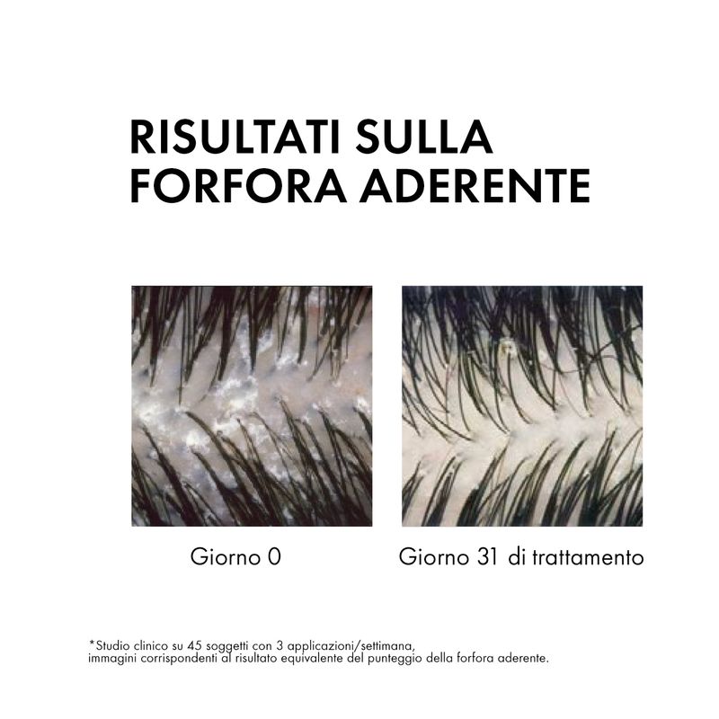 Vichy Dercos shampoo antiforfora capelli grassi 200 ml-3