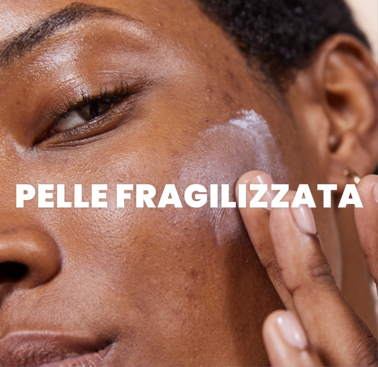 Pelle fragilizzata