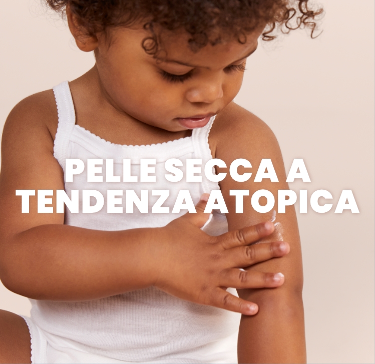 Pelle secca a tendenza atopica